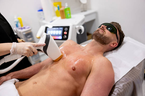 ultimate guide to laser hair removal